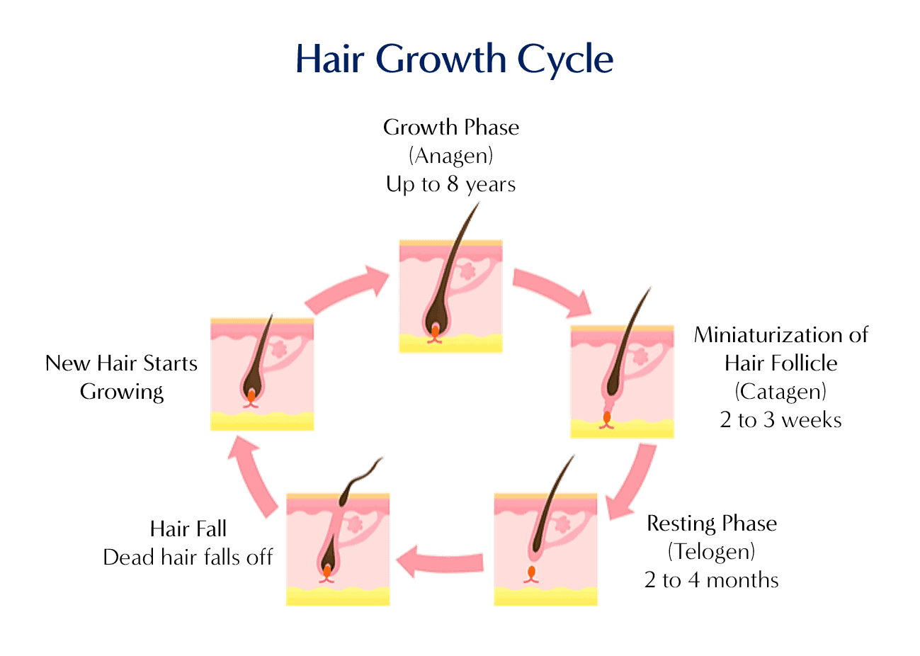 hair-loss-treatment-in-singapore-dream-plastic-surgery