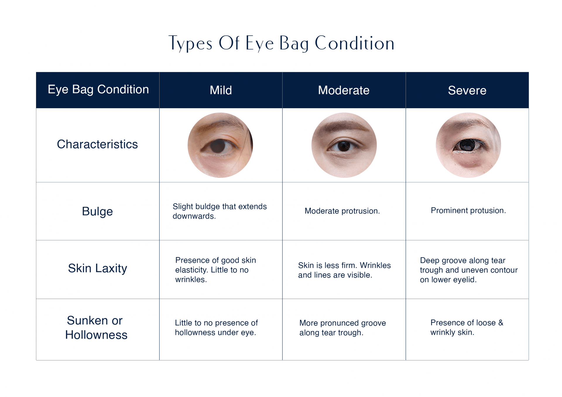 Types of eye bag conditions