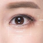 ptosis droopy eyelid causes treatment surgery