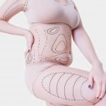 Liposuction in singapore - is it safe