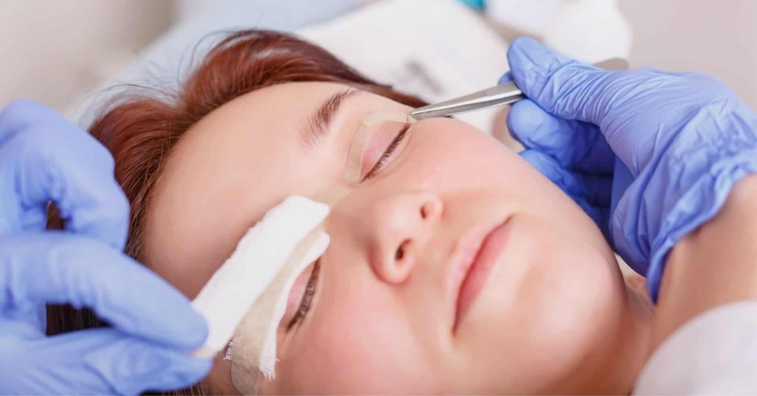 double eyelid surgery recovery