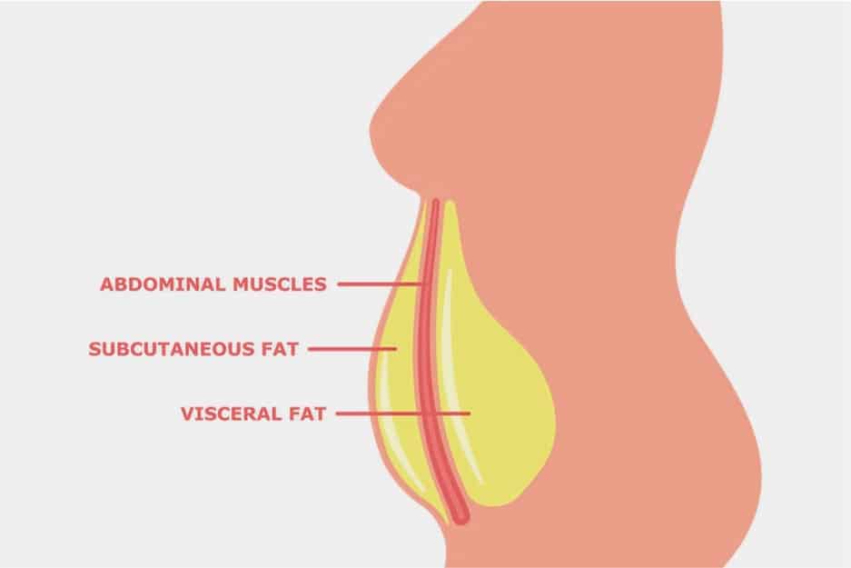 fats that can be removed through liposuction surgery
