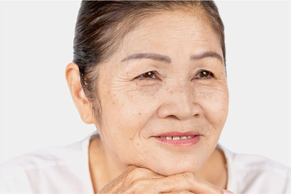 aging causes droopy eyelids