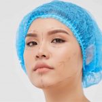 surgical and non-surgical facelift treatments at dream aesthetics & plastic surgery singapore