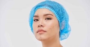 surgical and non-surgical facelift treatments at dream aesthetics & plastic surgery singapore