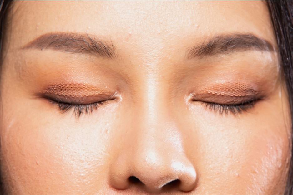 double eyelid takes and glues causes droopy eyelids