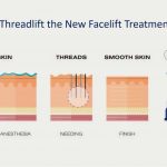 is threadlift the new facelift