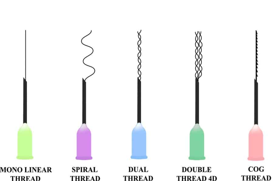 types of threads for threadlift