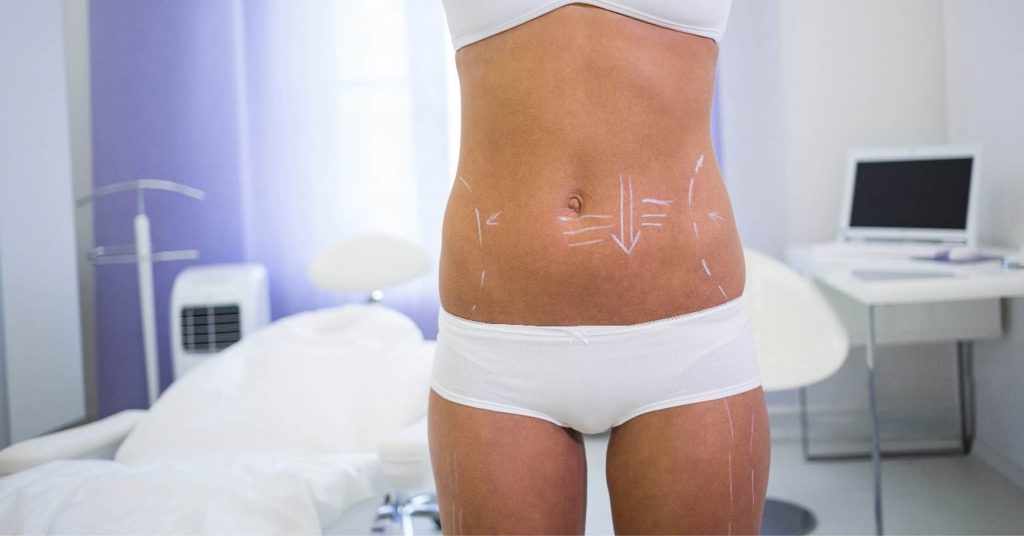 things to avoid before liposuction