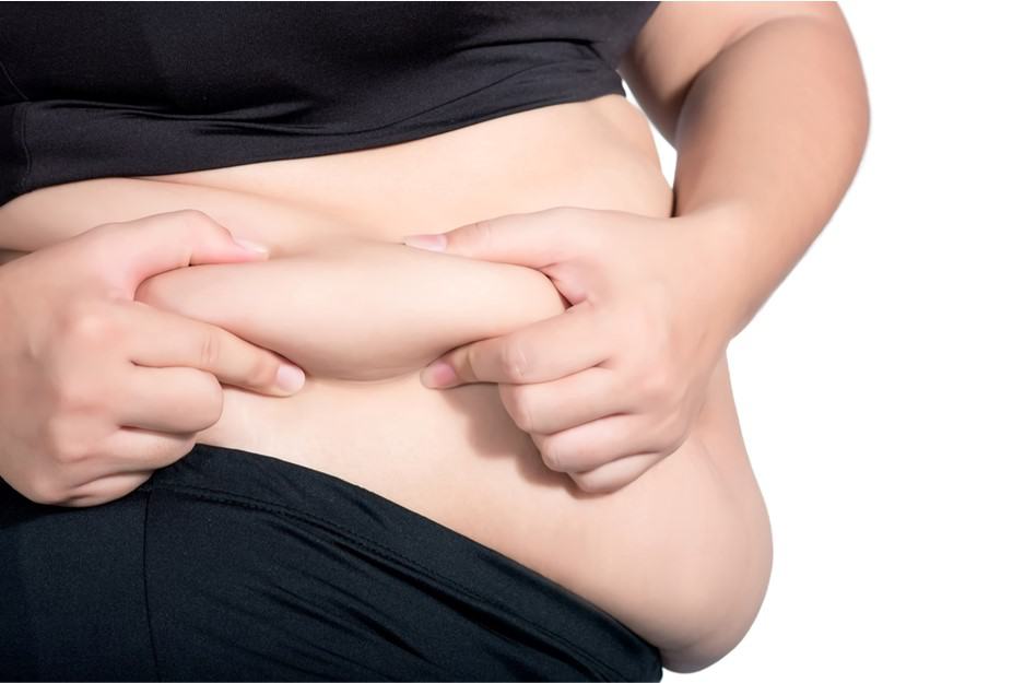 is liposuction reasonable for morbidly obese people