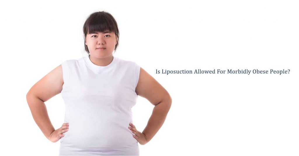 is liposuction for morbidly obese people