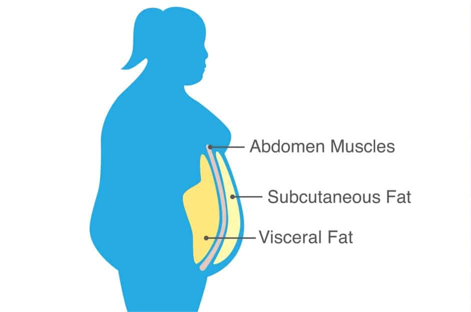fats suitable for liposuction