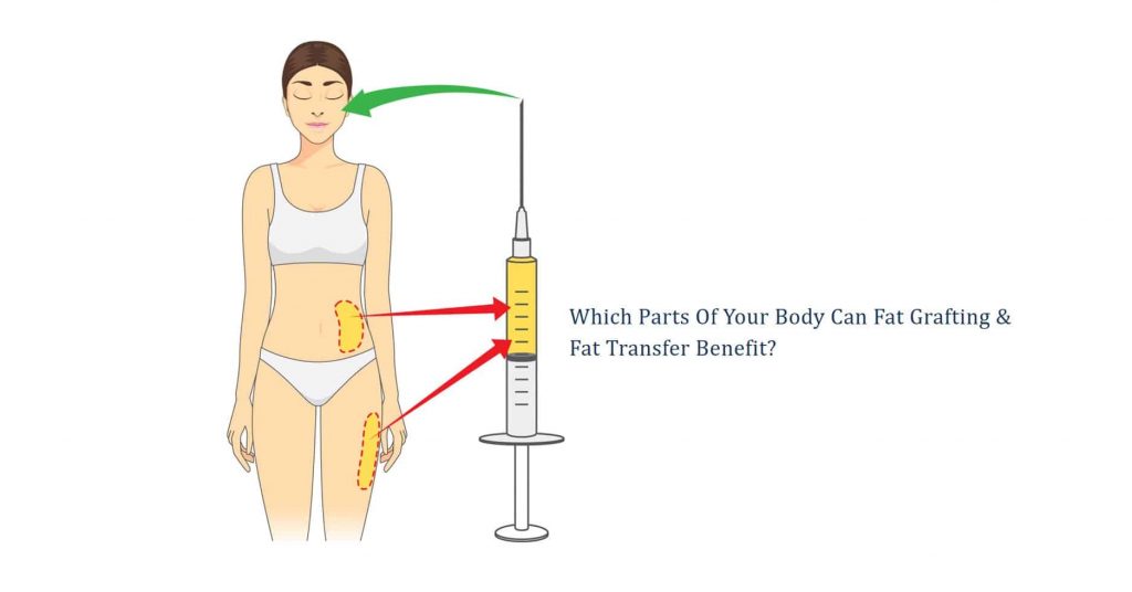which parts of your body can benefit from fat grafting