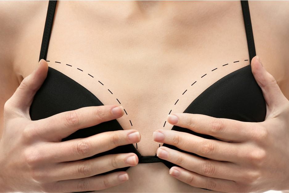breast augmentation increase breast size