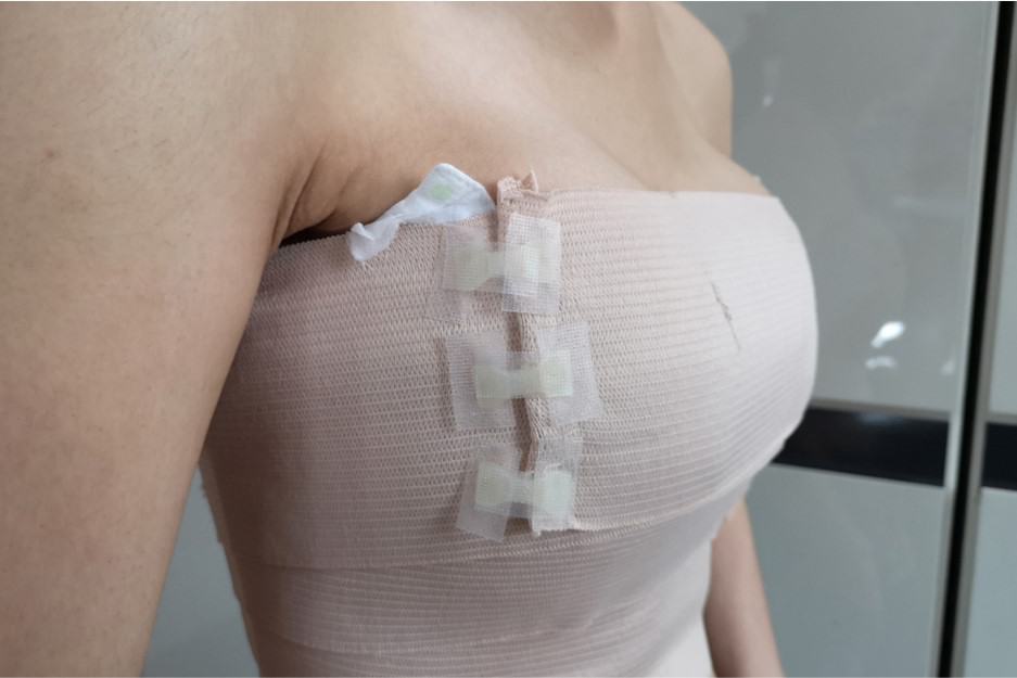 cons of breast augmentation