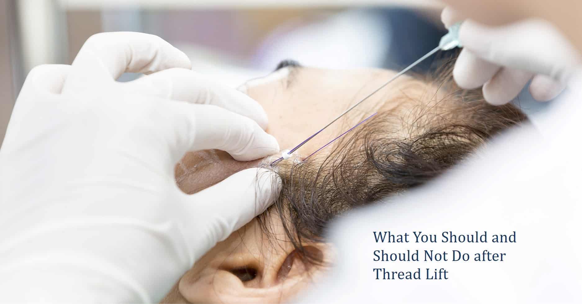 what you should and should not do after threadlift