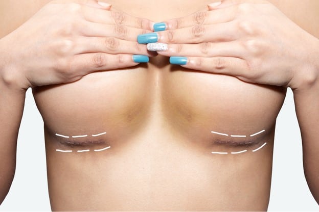 disadvantages of a fat transfer breast enlargement