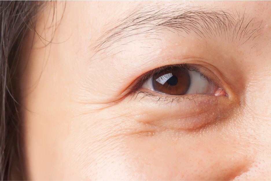 eye shows the first signs of aging