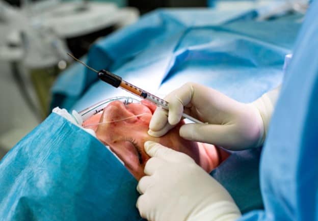 face fat grafting surgery procedure