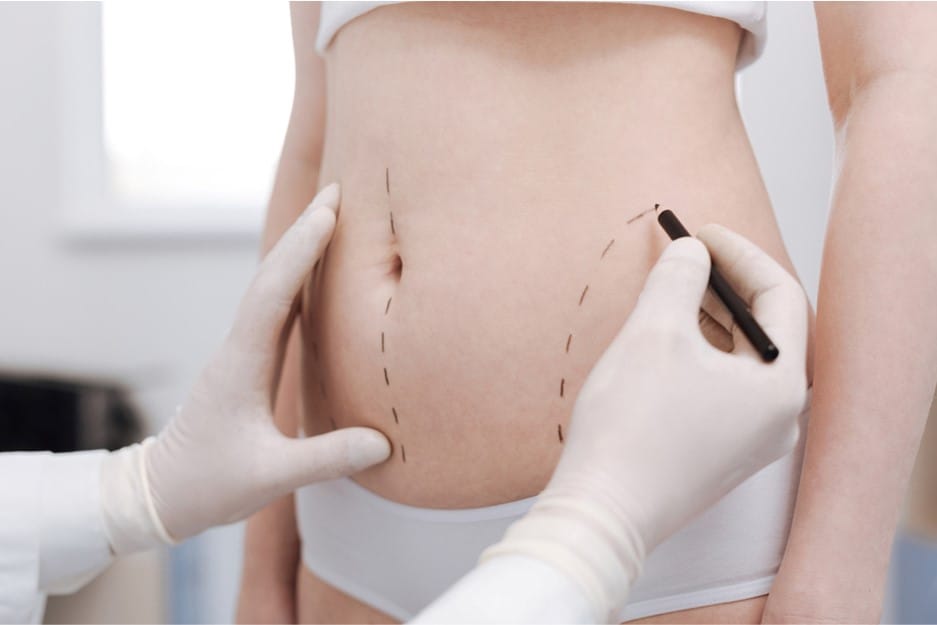 treatment time for liposuction