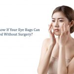how to know if eye bags can be removed without surgery