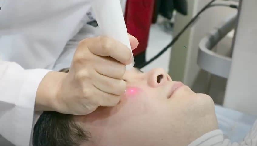pico laser for eye bag rejuvenation