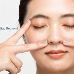 eye bag removal cost in singapore