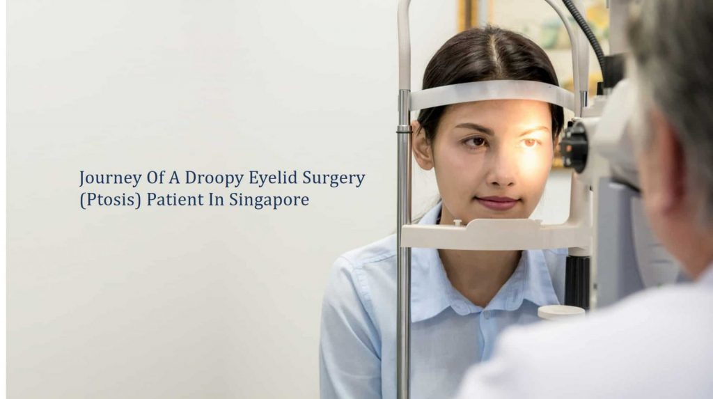 journey of a droopy eyelid surgery patient
