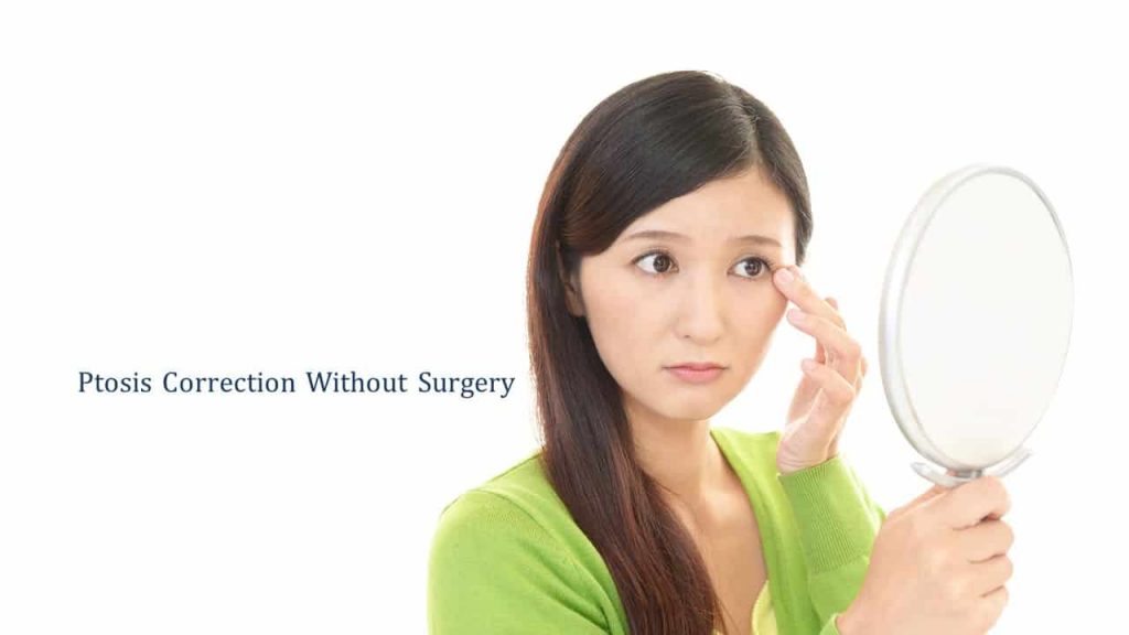 ptosis correction without surgery