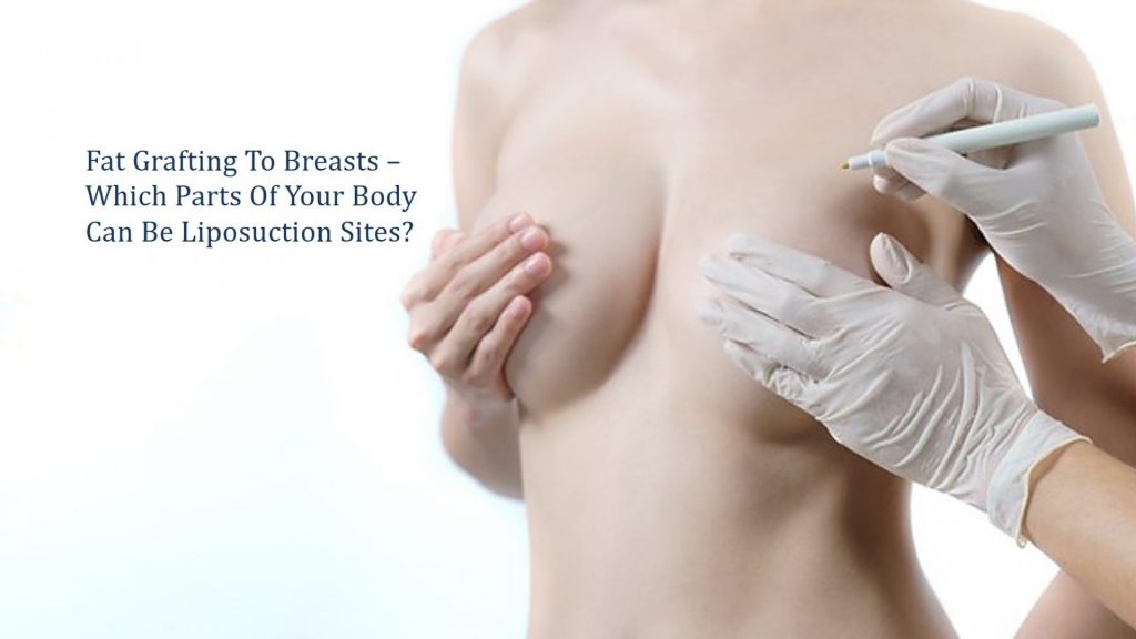 fat transfer to breast- which parts of your body can be liposuction sites