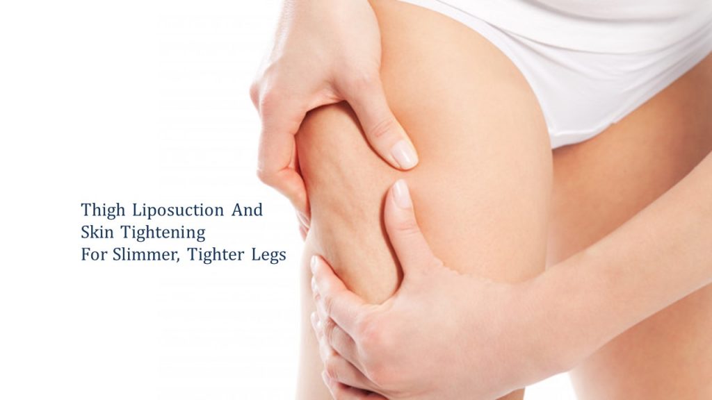 thigh liposuction for slimmer legs