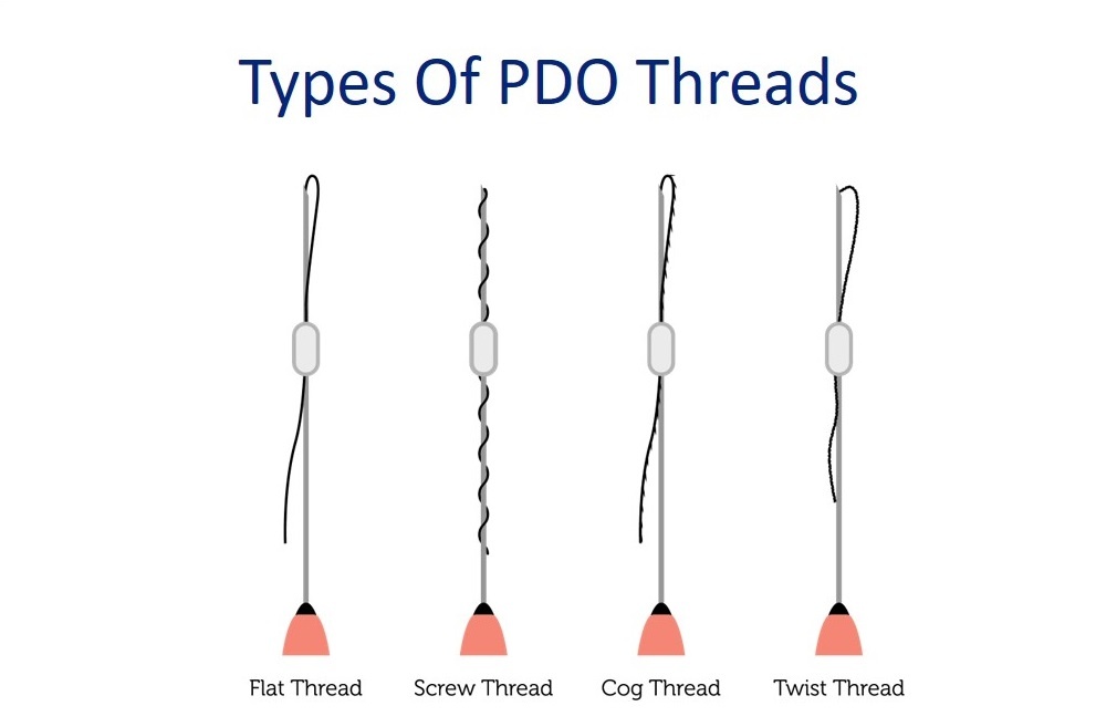 various types of pdo threads for skin tightening