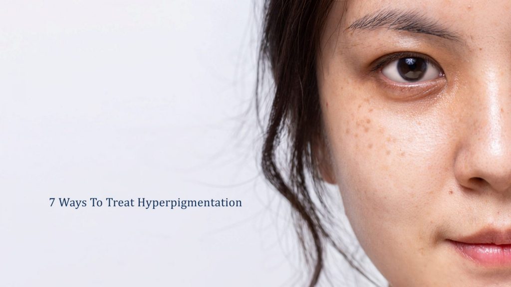 7 ways to treat hyperpigmentation