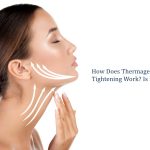 how does thermage skin tightening work