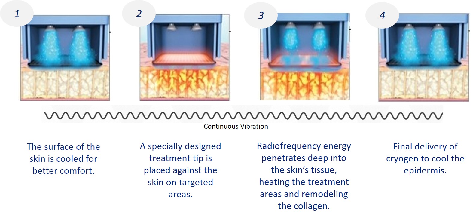 how does thermage help with skin rejuvenation