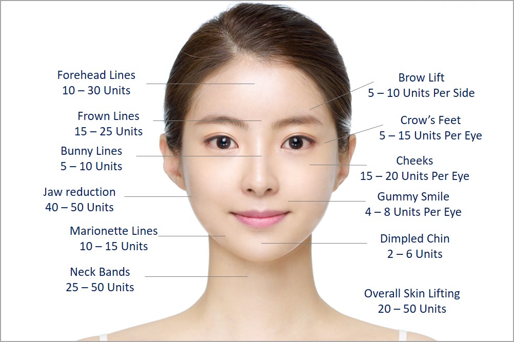 how much botox is required on different parts of the face