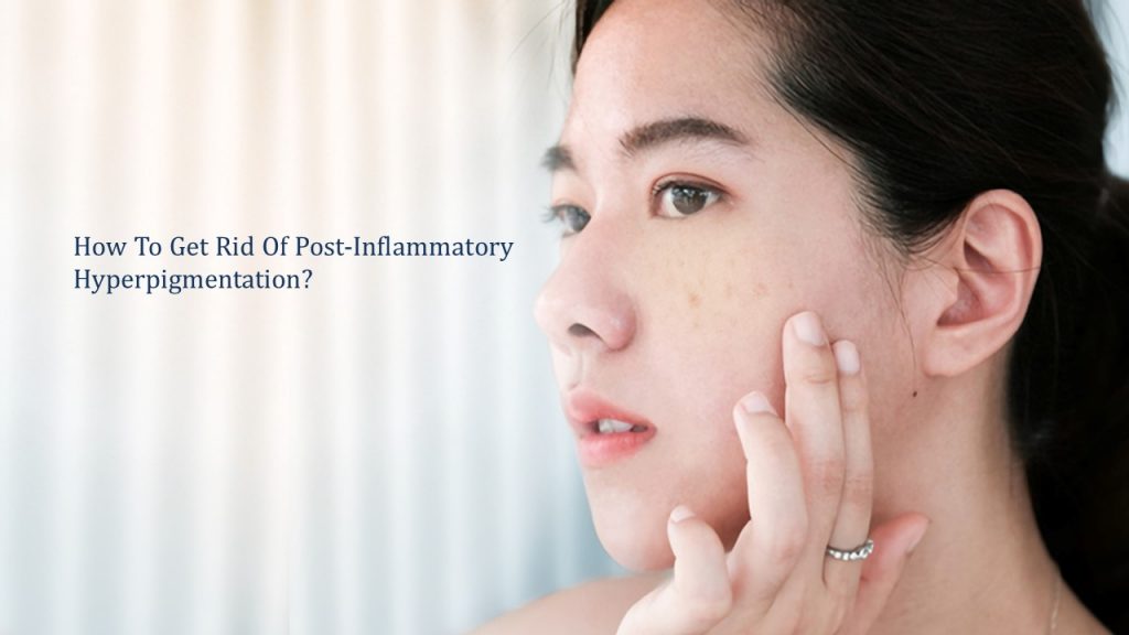 how to get rid of post inflammatory hyperpigmentation