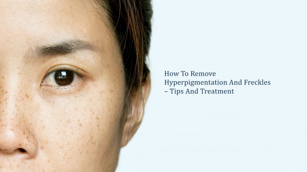 how to remove pigmentation and freckles