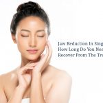 jaw reduction in singapore without surgery
