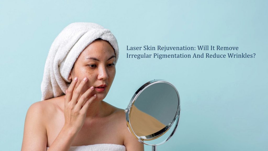 laser skin rejuvenation - will it remove irregular pigmentation