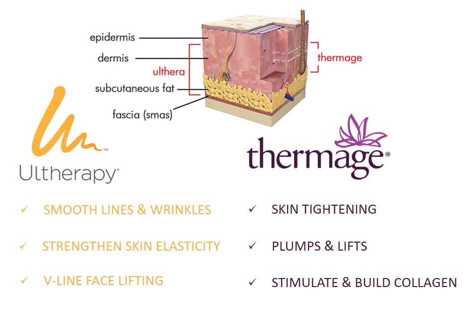 ultherapy ve thermage