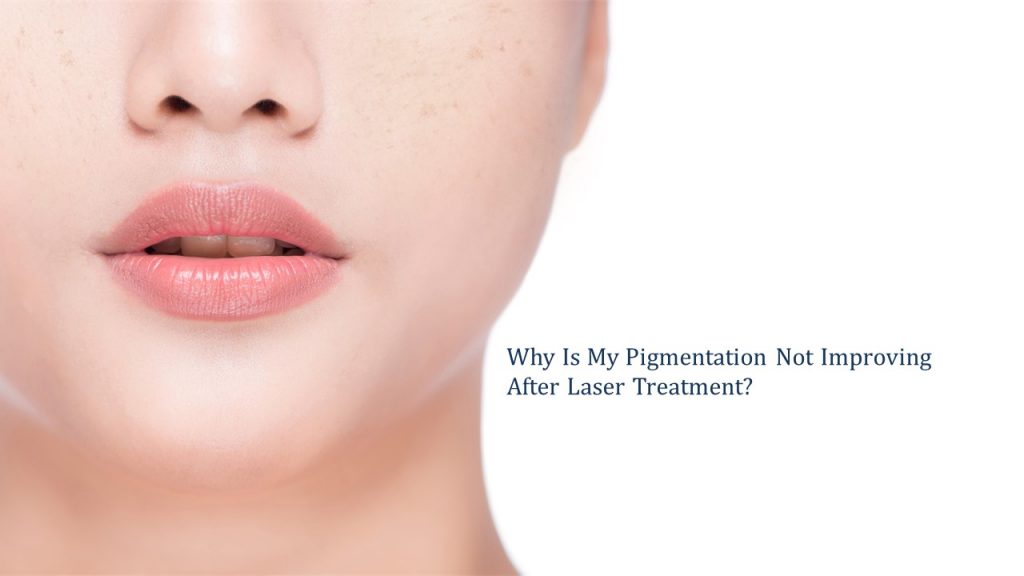 why is my pigmentation not improving after laser treatment
