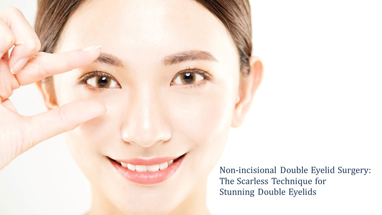 non-incisional double eyelid technique - the scarless technique for stunning double eyelids