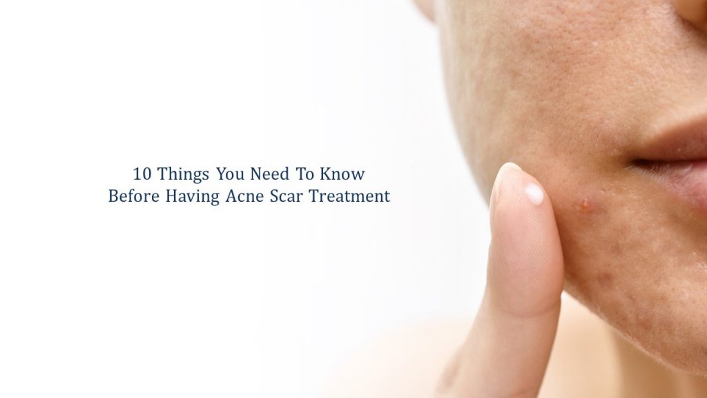 10 things you need to know before having acne scar treatment