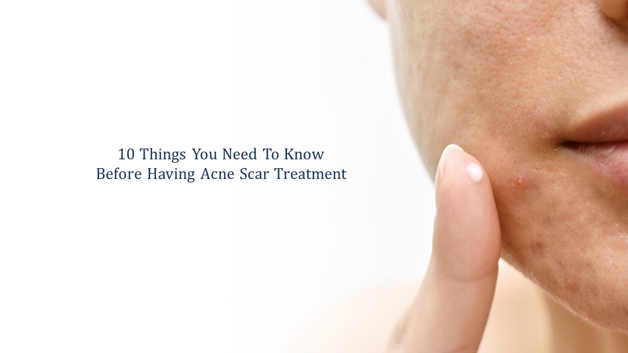 10 things you need to know before having acne scar treatment