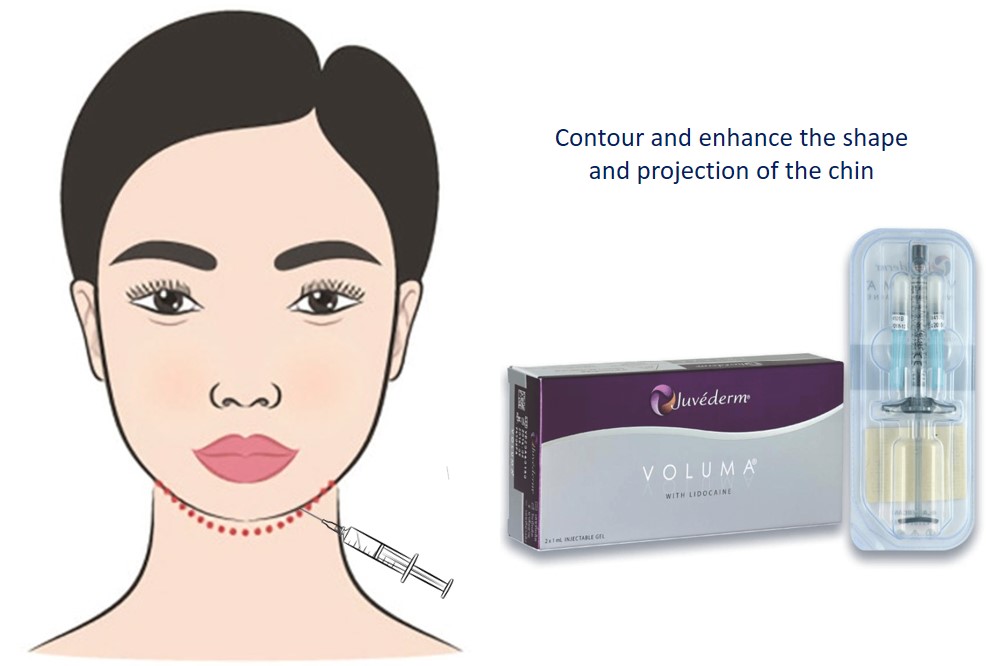 Remodel Your Face for a Youthful V-Shape with the 1st Instant