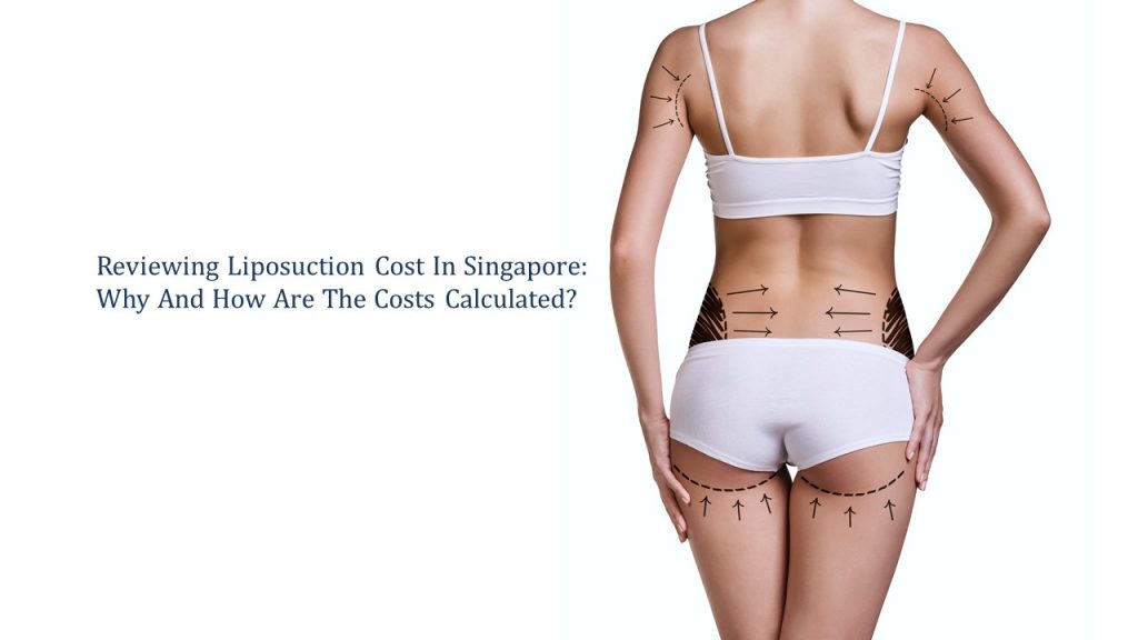 reviewing liposuction cost in singapore-why and how are the cost calculated