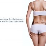 reviewing liposuction cost in singapore-why and how are the cost calculated