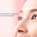 surgery for double eyelids in singapore - know if you are an ideal candidate
