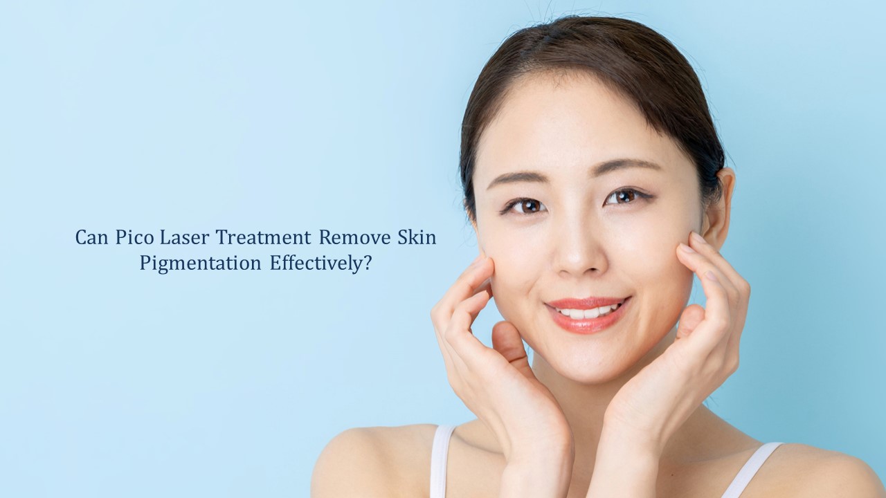 can pico laser remove skin pigmentation effectively